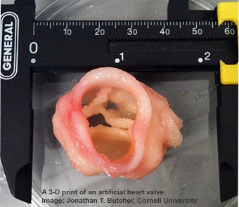 Creating-Valve-Tissue-Using-3D-Bioprinting 